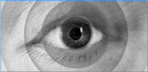 Alterazione della percezione dei colori